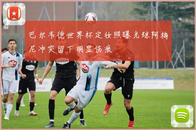 巴尔韦德世界杯定妆照曝光琼阿梅尼冲突留下明显伤痕